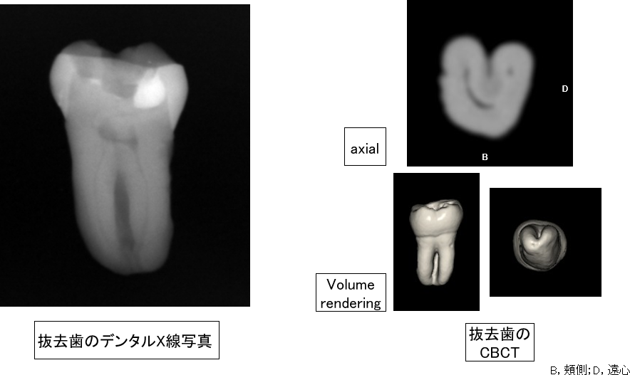 樋状根