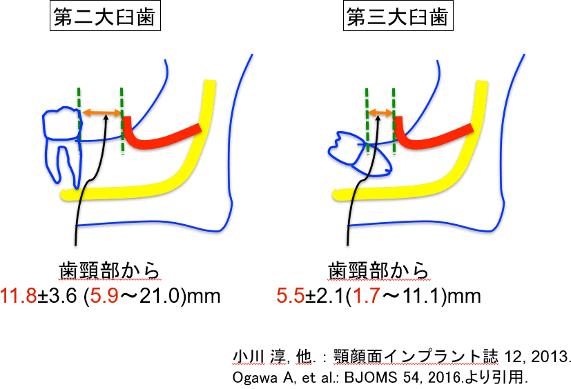 臼後孔の位置